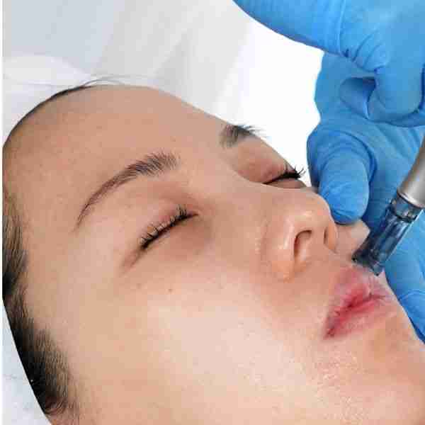 Woman receiving skin booster facial